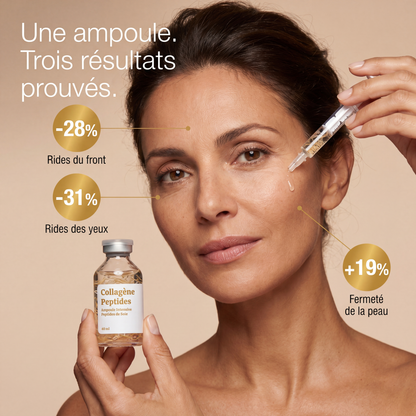 Lifting sans injection — porté par les fils de soie